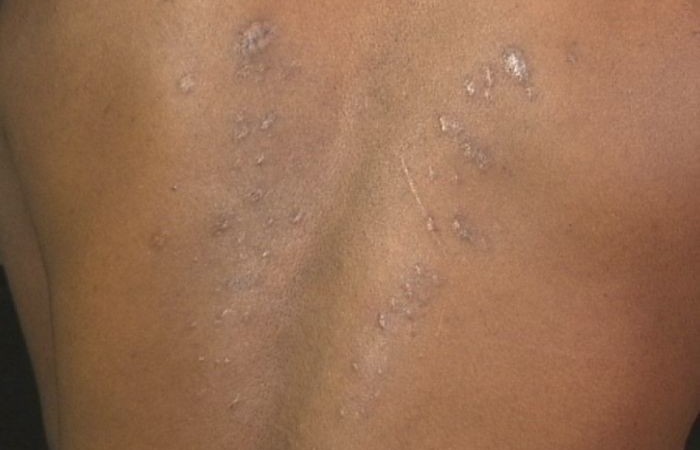 Australia accused of providing assistance to Sri Lanka to torture Tamils